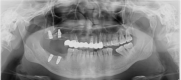 微信图片_2026-03-21_075754_072.png 微信图片_2026-03-21_075754_072.png